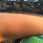 goosebumps-885563_1280